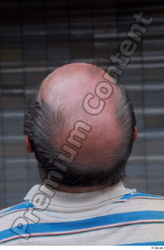 Head Hair Man White Casual Average Bald Street photo references
